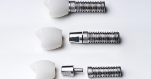 When should you use Dental Screws with a Conical Connection?