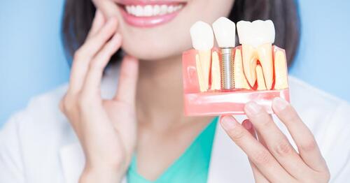 How Do Dental Implants Improve Oral Health?