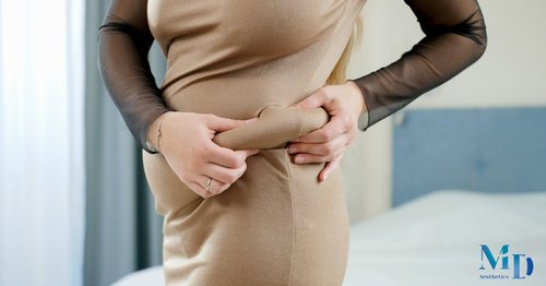 Belt Lipectomy Surgery: Restoring Body Harmony After Massive Weight Loss